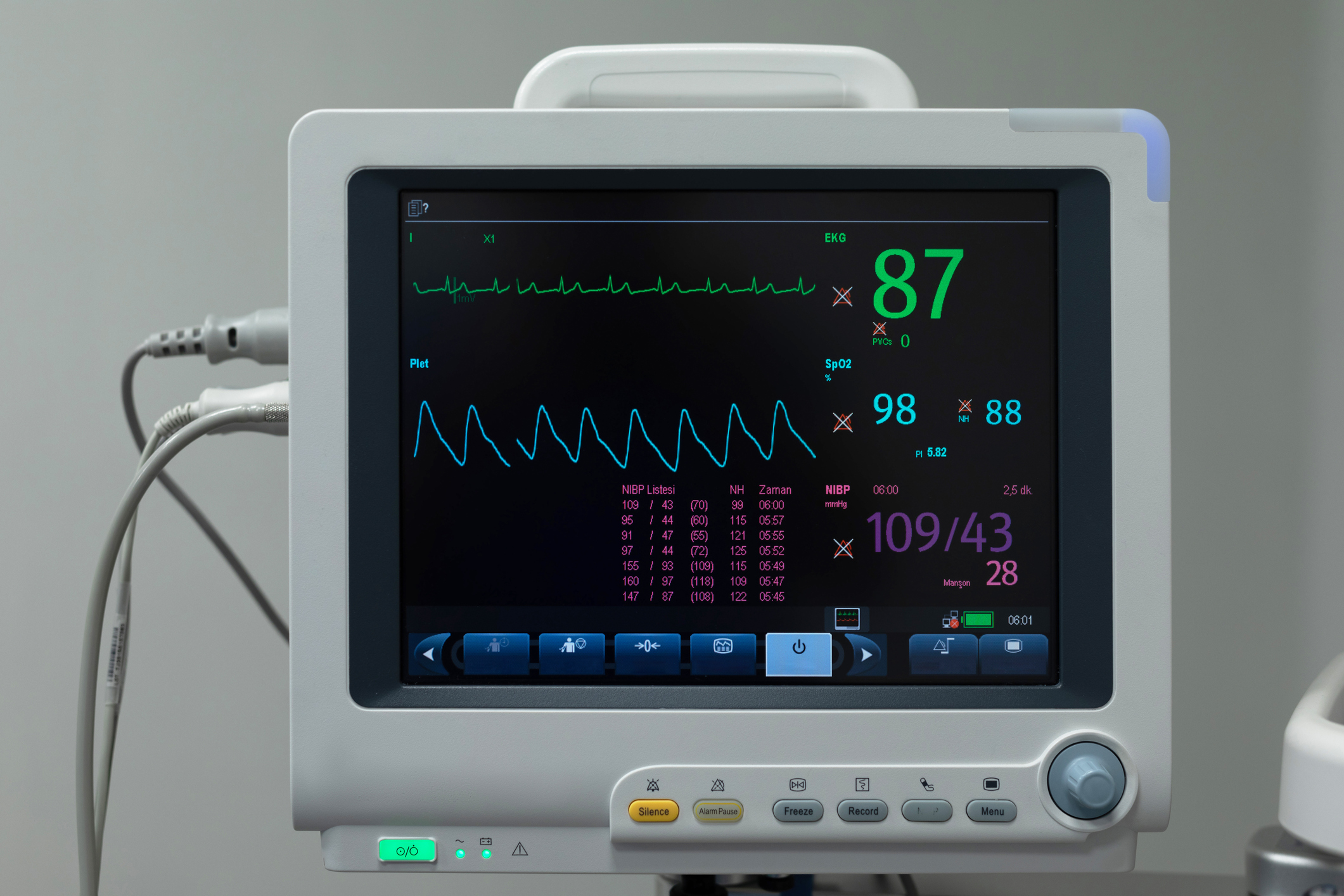 Get the best med student resources and tips for tackling EKGs!